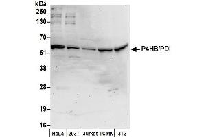 Western Blotting (WB) image for anti-Prolyl 4-Hydroxylase, beta Polypeptide (P4HB) (AA 50-100) antibody (ABIN7453155)