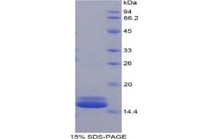 SDS-PAGE analysis of Mouse FABP4 Protein. (FABP4 蛋白)