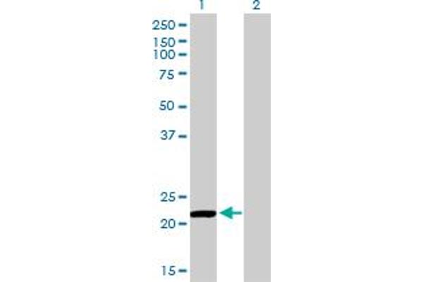 Peroxiredoxin 2 抗体  (AA 1-198)