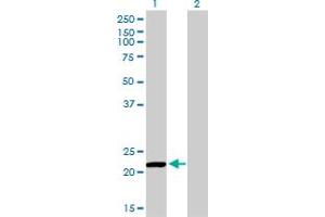 Western Blot analysis of PRDX2 expression in transfected 293T cell line by PRDX2 monoclonal antibody (M01), clone 4E10-2D2. (Peroxiredoxin 2 抗体  (AA 1-198))