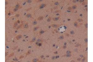 Detection of APC in Mouse Brain Tissue using Polyclonal Antibody to Adenomatosis Polyposis Coli Protein (APC) (APC 抗体  (AA 2636-2845))