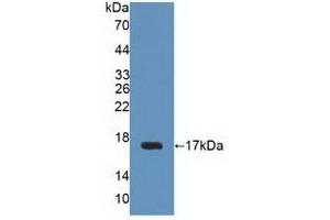 Figure. (Uroplakin 2 抗体  (AA 26-153))