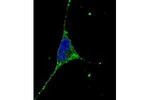 Fluorescent confocal image of SY5Y cells stained with PODXL (C-term) antibody. (PODXL 抗体  (C-Term))
