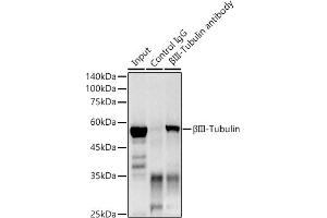 Immunoprecipitation (IP) image for anti-Tubulin, beta 3 (TUBB3) antibody (ABIN7271049)