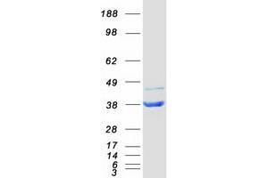 Western Blotting (WB) image for Nudix (Nucleoside Diphosphate Linked Moiety X)-Type Motif 5 (NUDT5) protein (Myc-DYKDDDDK Tag) (ABIN2727763)