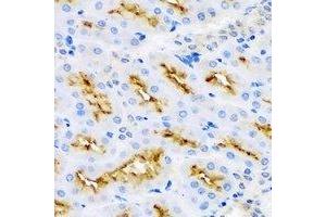Immunohistochemical analysis of MBP staining in rat kidney formalin fixed paraffin embedded tissue section. (MBP 抗体)