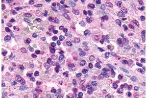 Anti-XPR1 antibody  ABIN1049493 IHC staining of human spleen.