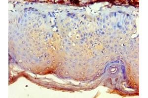 Immunohistochemistry (IHC) image for anti-NCK Adaptor Protein 2 (NCK2) (AA 1-380) antibody (ABIN7149353)