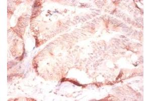 Immunohistochemistry (IHC) image for anti-Collagen, Type IV, alpha 2 (COL4A2) (AA 1493-1712) antibody (ABIN7148243)