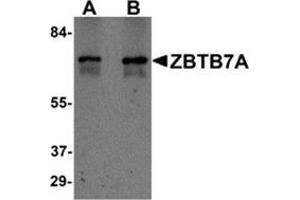 Western blot analysis of ZBTB7A in Human ovary tissue lysate with ZBTB7A / Pokemon antibody at (A) 1 and (B) 2 μg/ml. (ZBTB7A 抗体  (N-Term))