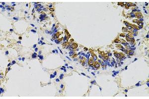 Immunohistochemistry of paraffin-embedded Mouse lung using CD59 Polyclonal Antibody (CD59 抗体)