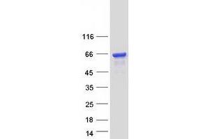 Validation with Western Blot (EPS8-Like 3 Protein (EPS8L3) (Transcript Variant 3) (Myc-DYKDDDDK Tag))