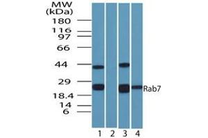 Rab-7 Western Blot. (RAB7A 抗体)