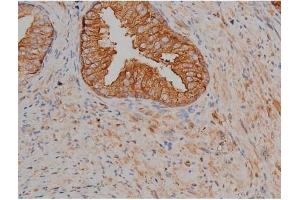 ABIN6267356 at 1/200 staining Human prostate tissue sections by IHC-P. (MAPT 抗体  (pSer404))