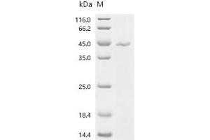 (Tris-Glycine gel) Discontinuous SDS-PAGE (reduced) with 5 % enrichment gel and 15 % separation gel.