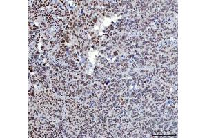 IHC analysis of YY1 using anti-YY1 antibody (ABIN7603000).