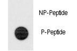 Dot blot analysis of phospho-TERT antibody. (TERT 抗体  (pSer1125))