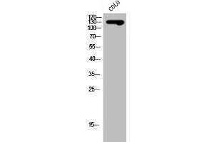 Western Blot analysis of COLO cells using SLC4A8/10 Polyclonal Antibody (SLC4A8/SLC4A1 (Internal Region) 抗体)
