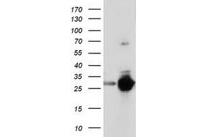 Western Blotting (WB) image for anti-Sepiapterin Reductase (SPR) antibody (ABIN1501113) (SPR 抗体)