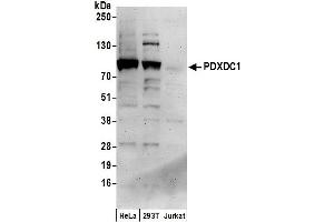 anti-Pyridoxal-Dependent Decarboxylase Domain Containing 1 (PDXDC1) (AA 725-775) antibody