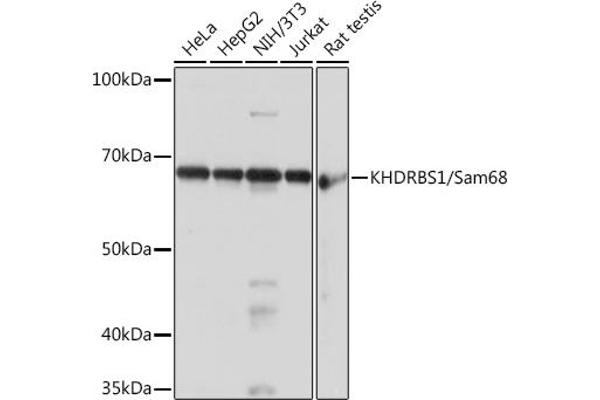 KHDRBS1 抗体