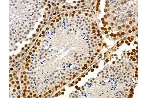 Phospho-SMC1 (Ser966) Antibody at 1/100 staining Mouse testis tissue by IHC-P. (SMC1A 抗体  (pSer966))