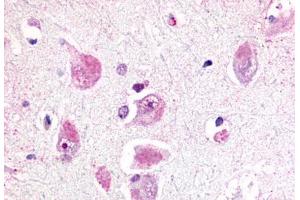 Anti-RXFP3 antibody  ABIN1049311 IHC staining of human brain, neurons and glia. (Relaxin 3 Receptor 1 抗体  (Cytoplasmic Domain))