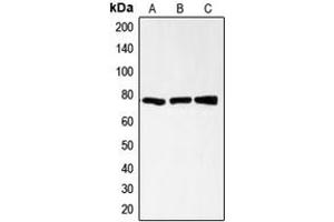 Western blot analysis of CD200R expression in HL60 (A), CCRFCEM (B), AML193 (C) whole cell lysates. (CD200R1 抗体  (C-Term))