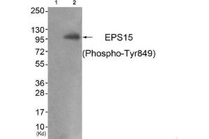 Western blot analysis of extracts from JK cells (Lane 2), using EPS15 (Phospho-Tyr849) Antibody. (EPS15 抗体  (pTyr849))