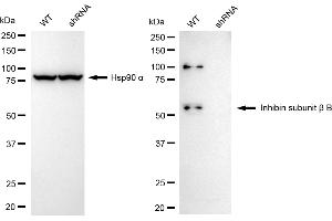 Western blotting analysis using inhibin subunit beta B antibody (ABIN7800941). (Recombinant Inhibin Subunit beta B 抗体)