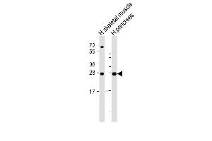 All lanes : Anti-CELA2B Antibody (Center) at 1:2000 dilution Lane 1: human skeletal muscle lysate Lane 2: human pancreas lysate Lysates/proteins at 20 μg per lane. (ELA2B 抗体  (AA 88-122))