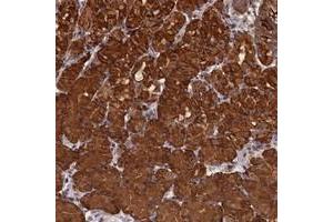 Immunohistochemical staining of human stomach with PIGN polyclonal antibody  shows strong cytoplasmic positivity in glandular cells at 1:200-1:500 dilution. (PIGN 抗体)