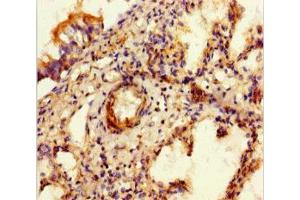 Immunohistochemistry of paraffin-embedded human lung tissue using ABIN7152342 at dilution of 1:100 (SULF1 抗体  (AA 105-372))