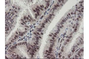 Image no. 11 for anti-RNA Binding Protein with Multiple Splicing (RBPMS) antibody (ABIN1500642)