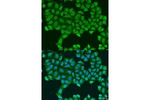 Immunofluorescence (IF) image for anti-ATP Synthase, H+ Transporting, Mitochondrial F1 Complex, O Subunit (ATP5O) (AA 24-213) antibody (ABIN6137338)
