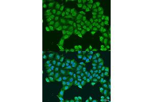 Immunofluorescence analysis of U2OS cells using ATP5O antibody. (ATP5O 抗体  (AA 24-213))