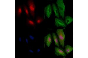ABIN6264736 and ABIN6279770 staining  cells by IF/ICC. (ARHGAP25 抗体  (Internal Region))