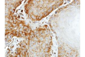 IHC-P Image Immunohistochemical analysis of paraffin-embedded SG xenograft, using EIF2 beta, antibody at 1:500 dilution.