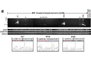 Western Blotting (WB) image for anti-Coiled-Coil Domain Containing 170 (CCDC170) (C-Term) antibody (ABIN2856492)