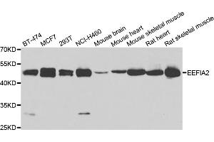 Western blot analysis of extracts of various cell lines, using EEF1A2 antibody (ABIN4903541) at 1:1000 dilution. (EEF1A2 抗体)