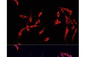 Immunofluorescence analysis of PC-12 cells using SMAD2 Polyclonal Antibody at dilution of 1:100. (SMAD2 抗体)