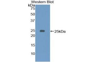 Western blot analysis of the recombinant protein. (CD79a 抗体  (AA 36-219))