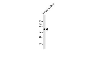 Anti-NKX2-1 Antibody (N-term) at 1:1000 dilution + TT cell nucleus lysate Lysates/proteins at 20 μg per lane. (NKX2-1 抗体  (N-Term))