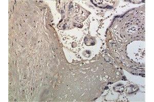 Immunohistochemistry (IHC) image for anti-Latent Transforming Growth Factor beta Binding Protein 1 (LTBP1) (AA 1-1138) antibody (ABIN1983334)