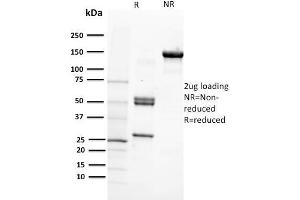 SDS-PAGE Analysis Purified CD29 Mouse Monoclonal Antibody (12G10). (ITGB1 抗体)