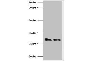 Western blot All lanes: COP9 signalosome complex subunit 7a antibody at 4 μg/mL Lane 1: Rat heart tissue Lane 2: Rat brain tissue Secondary Goat polyclonal to rabbit IgG at 1/10000 dilution Predicted band size: 30 kDa Observed band size: 30 kDa (COPS7A 抗体  (AA 1-275))