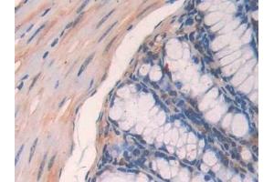 Immunohistochemistry (IHC) image for anti-Paraoxonase 2 (PON2) (AA 4-289) antibody (ABIN7440995)