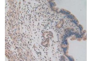 IHC-P analysis of Mouse Uterus Tissue, with DAB staining. (NUP85 抗体  (AA 418-653))