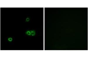 Immunofluorescence analysis of A549 cells, using MARCH5 Antibody. (MARCH5 抗体  (AA 21-70))
