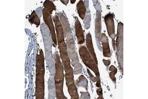 Immunohistochemical staining of human skeletal muscle with RWDD2B polyclonal antibody  shows strong cytoplasmic positivity in a heterogeneous staining pattern. (RWDD2B 抗体)